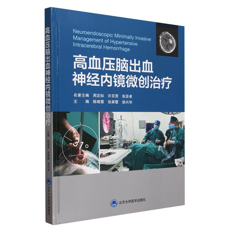 高血压脑出血神经内镜微创治疗