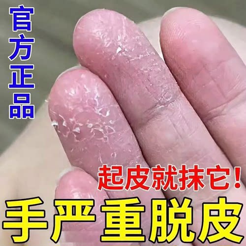 【手脚脱皮】季节性脱皮抑菌膏