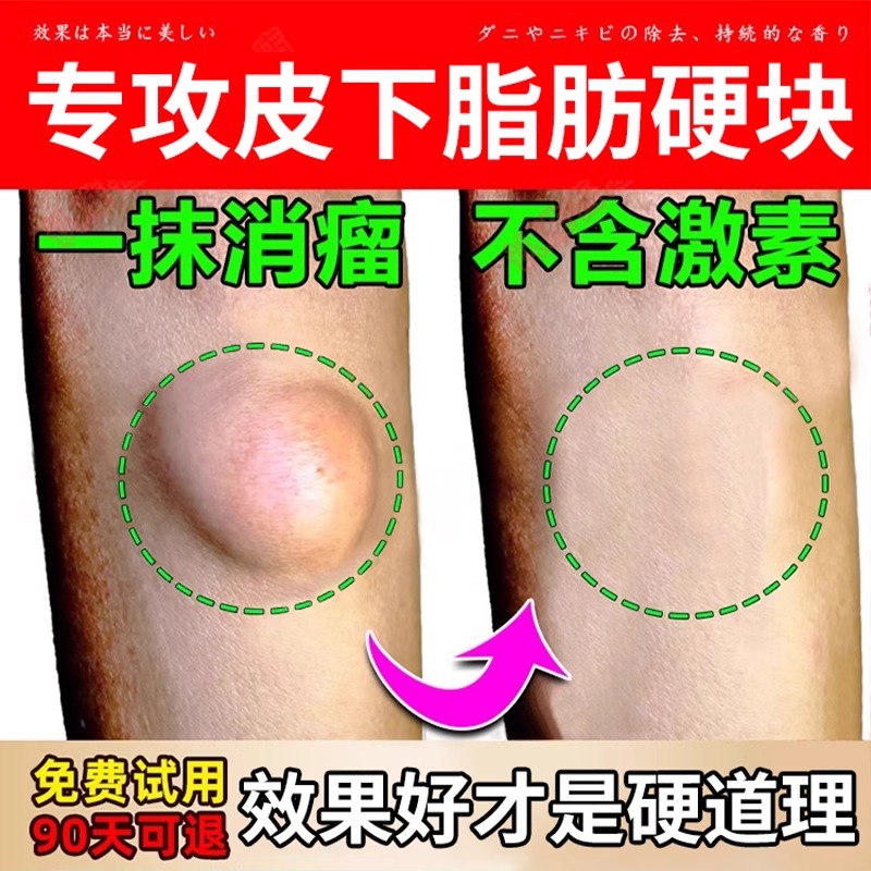 【早用早舒服】脂肪消散膏