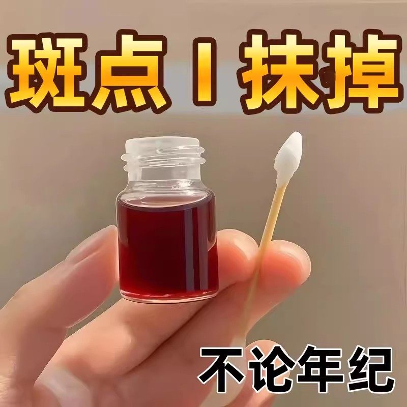 中老年祛斑水强力去除手部脸部斑专用膏官方正品精华祛黄褐斑雀斑