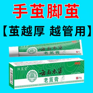 脚底老茧去除软化剂脚上去死皮根脚垫硬皮鸡眼药膏脚钉祛除鸡茧眼