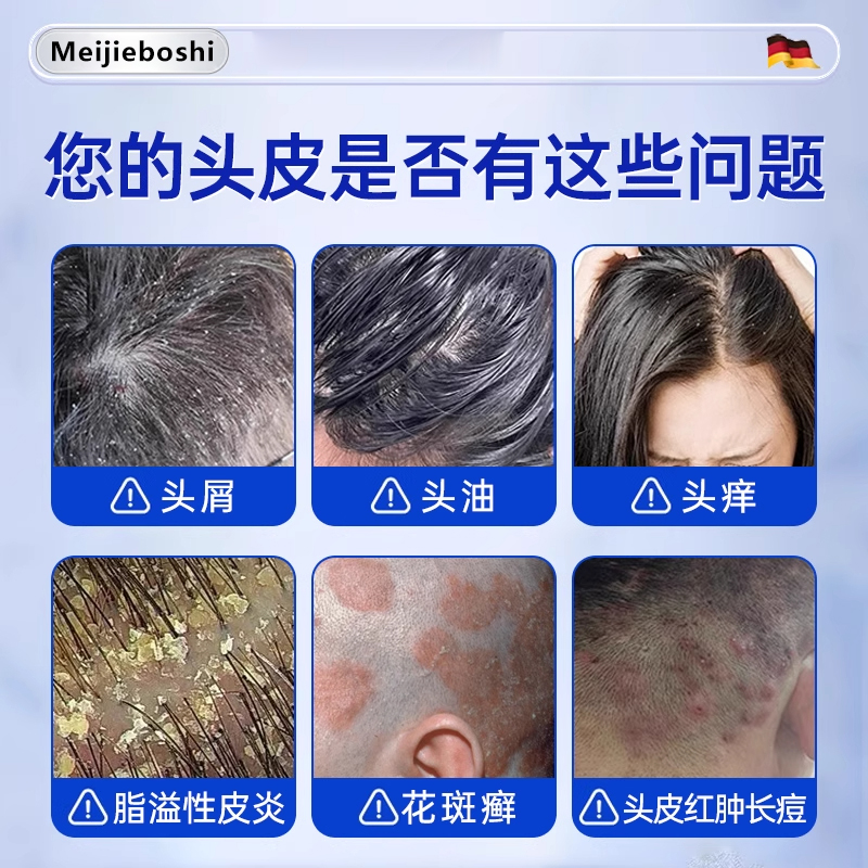 煤焦油洗剂洗发水脂溢性头皮止痒去屑抑菌马拉色菌正品官方旗舰bp