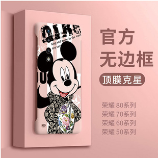 适用荣耀400pro手机壳新款 保护壳高级感女60se创意男卡通超薄50pro散热防摔硬70 米奇衣服x60pr无边框80曲屏版