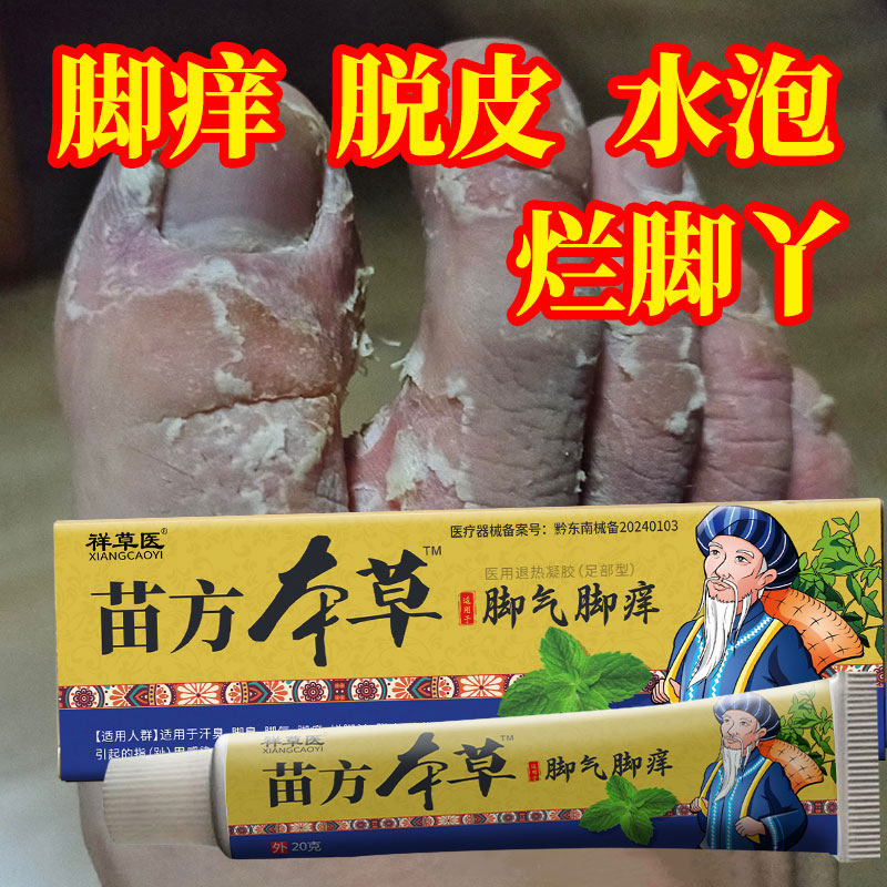苗方脚气脚痒膏一盒20g