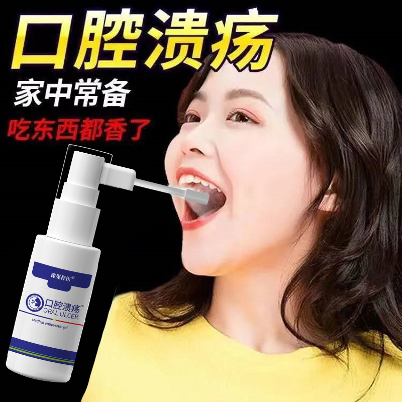 口腔喷雾口腔溃疡牙结石喷雾祛牙渍牙黄口臭口腔生疮气泡嘴巴糜烂