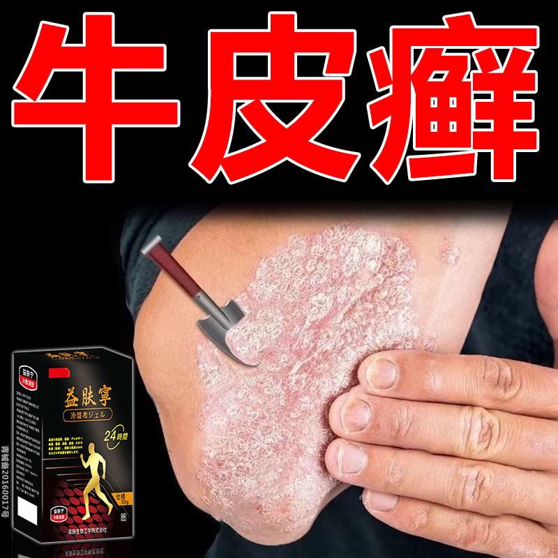日本牛皮癣专用膏药贴皮肤瘙痒外用股癣红斑手足癣头癣银屑癣凝胶