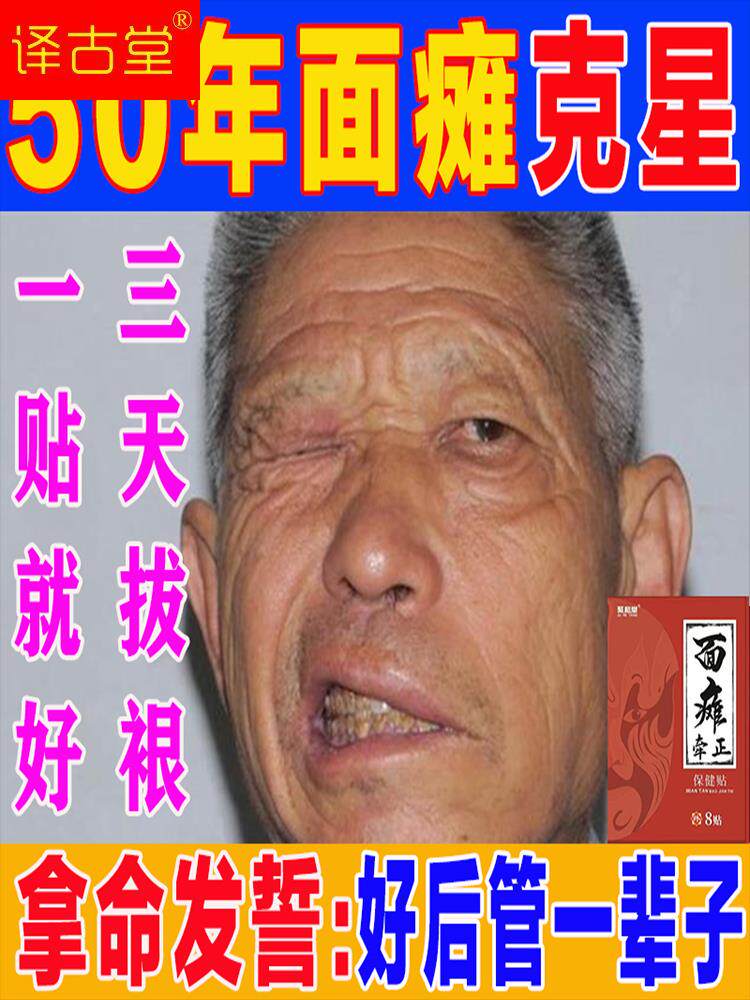 面瘫贴面瘫牵正瘫后遗症嘴歪眼斜脸部僵硬抽搐三叉神经麻木专用贴