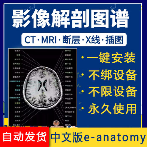 影像解剖图谱app 中文e-anatomy人体断层影像解剖ct mri 放射软件