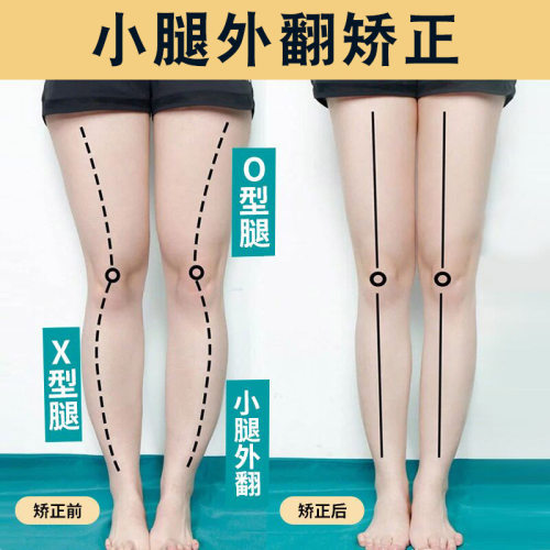 Xo腿矫正鞋垫销量排行榜 Xo腿矫正鞋垫品牌热度排名 小麦优选 Xo腿矫正鞋垫销量排行榜 Xo腿矫正鞋垫品牌热度排名 小麦优选