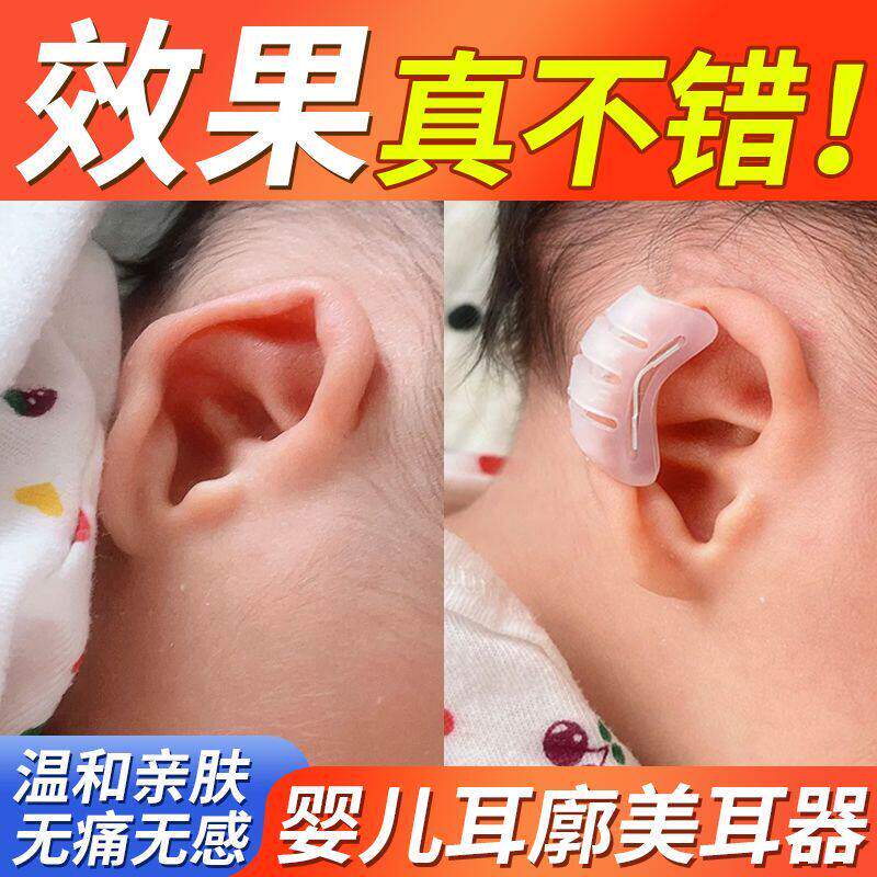 新生儿耳廓硅胶矫正器耳