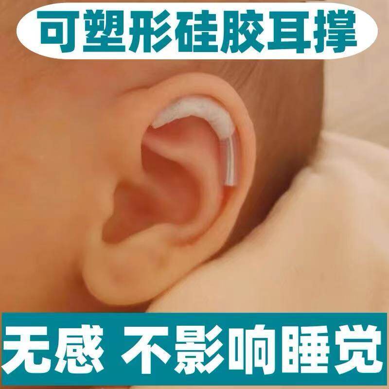 耳朵矫正器婴儿新生的廓