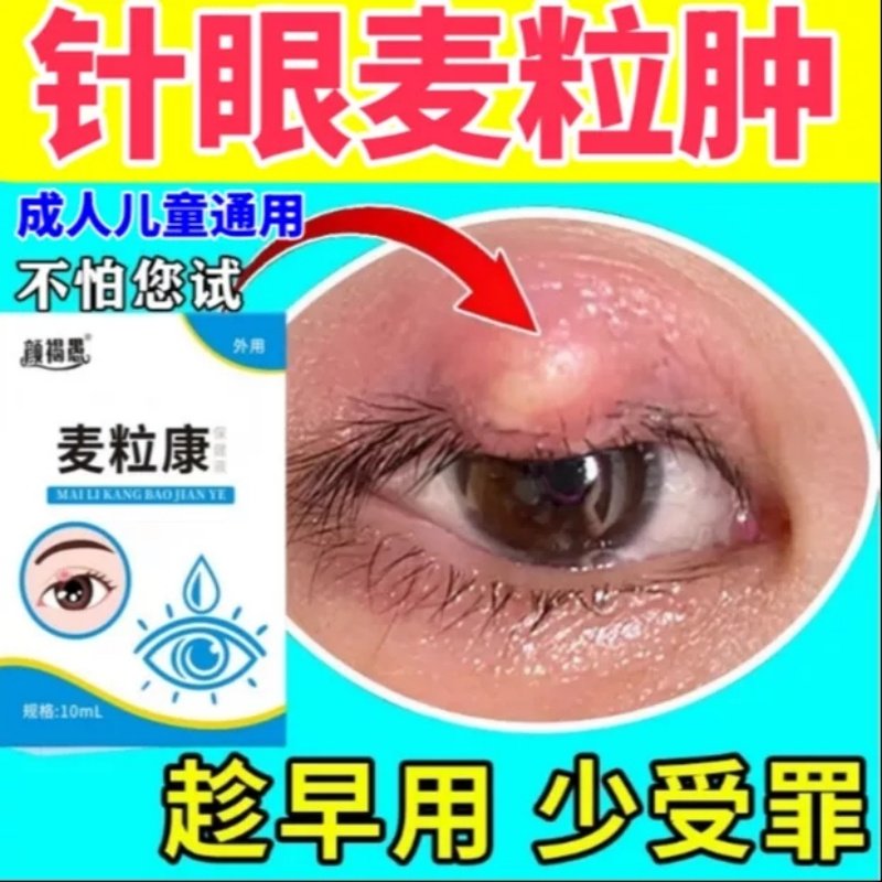 麦粒肿针眼滴眼液儿童成人霰粒肿眼睛红肿疼有硬块黄色脓点眼药水