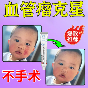 血管瘤婴儿专用药血管痣去除修复毛细血管樱桃状血管瘤专用药神器