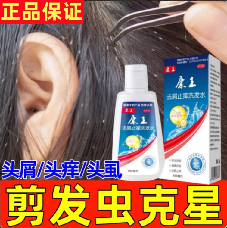 去剪发虫洗发水成人儿童卷发虫吃发虫头上小白点除头螨康王洗发水