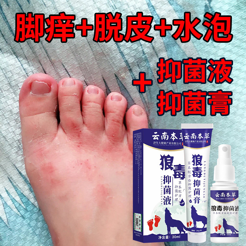 正品铍白金西域毒狼脚气王喷剂脱皮水泡型真菌感染止痒烂脚丫抑菌