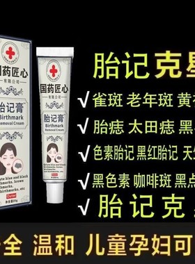 胎记去除神器胎记膏分解咖啡斑胎记黑色素隐形贴遮盖膏去除神器