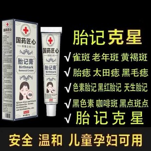 胎记去除神器胎记膏分解咖啡斑胎记黑色素隐形贴遮盖膏去除神器