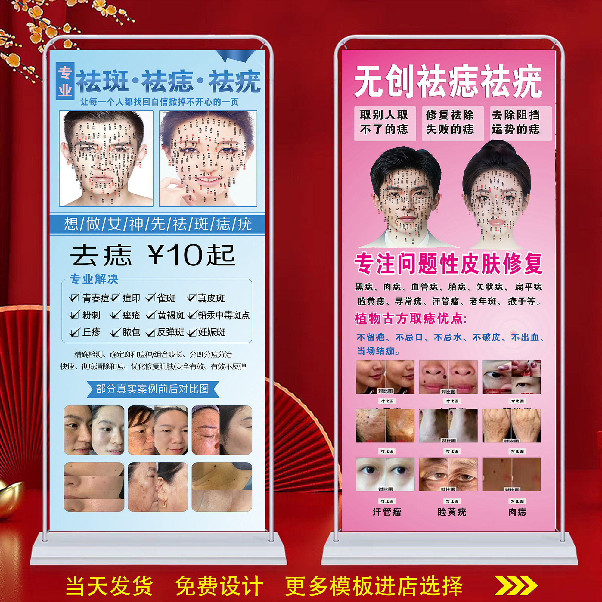美容院点痣祛斑广告挂图海报门型展架户外贴纸定制祛痣祛疣宣传图