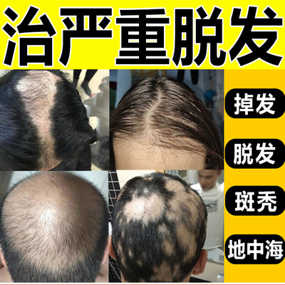 天麻首乌片德海滋阴补肾头痛耳鸣脱发白发溢脂性脱发