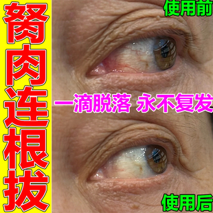 聚乙烯醇滴眼液瑞珠溴芬酸钠日本普罗纳克