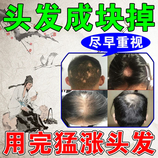 生发乌发丸特伶片乌发片乌发治疗口服生发治白发的药防脱发脱发