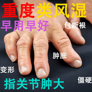 云南白药膏药舒筋活血止痛喷剂酊活血散淤消痛町非气雾剂喷跌打扭