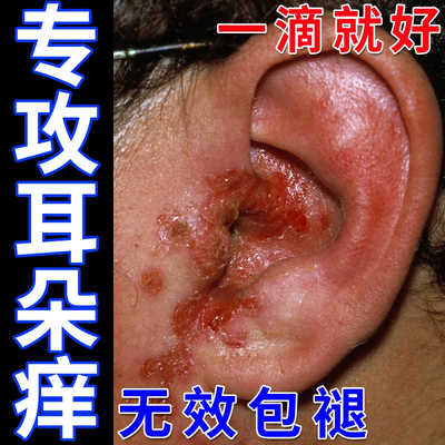 硼酸酒精洗耳液滴耳液冰片人用耳朵痒滴耳油道清洁炎专用中耳炎