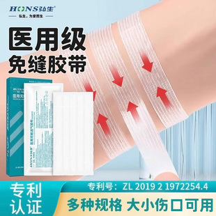 拉链式创可贴医用儿童疤痕减张贴剖腹产术后伤口减张器皮肤缝合器