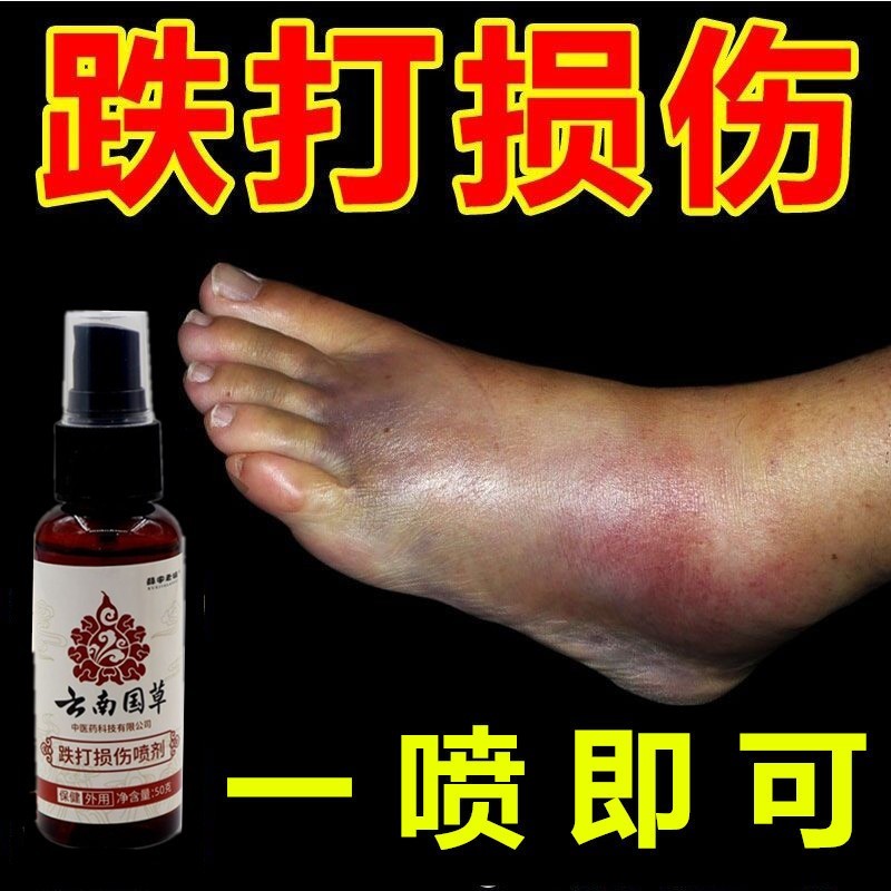 云南国草药跌打损伤喷剂舒筋消肿止痛筋伤动骨活血化瘀脚踝扭伤