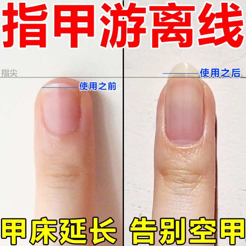 指甲游离线生长液护甲油增长液延长护理营养油养甲床分离空甲修复