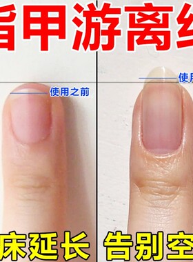 指甲游离线生长液护甲油增长液延长护理营养油养甲床分离空甲修复