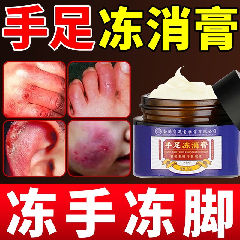 冻疮膏止痒冻伤膏正品防儿童冻裂耳朵消肿修复护手足霜正品