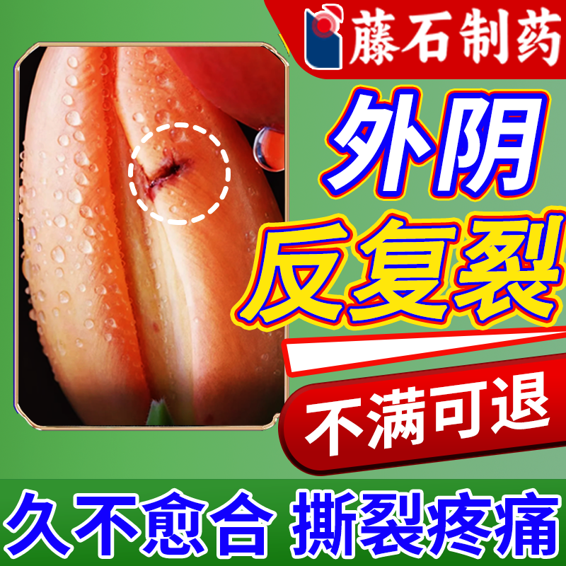 外阴反复裂口肿痛医用促进愈合膏