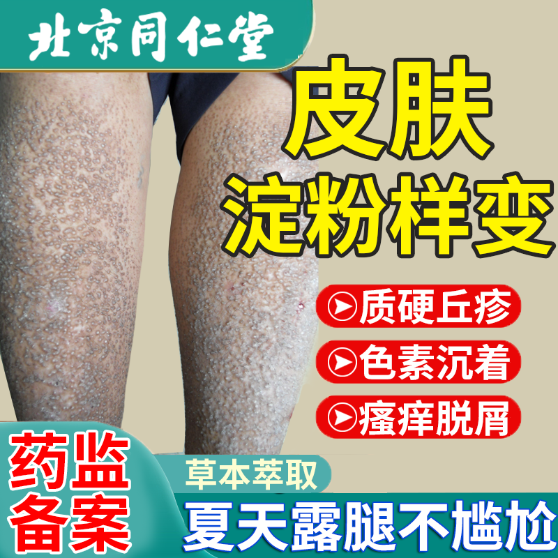 淀粉样变小腿胳膊皮肤粗糙专用顽固后背黑色素可搭治疗仪膏药贴jw