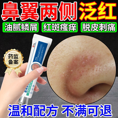 专研鼻翼两侧泛红脱皮凝胶