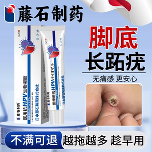 藤石制薬跖疣病毒疣专用蚩尤膏去石疣根足部脚底连根拔拓疣趾疣OZ