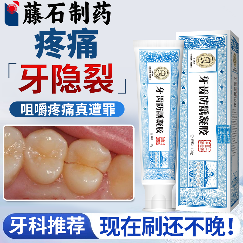 牙齿有裂纹裂开牙裂缝修补牙隐裂修可搭牙膏用复断裂牙裂生长液OZ