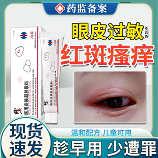 眼皮红肿痒眼睛周围过敏发痒眼皮癣过敏性皮炎眼角干燥起皮掉屑JW