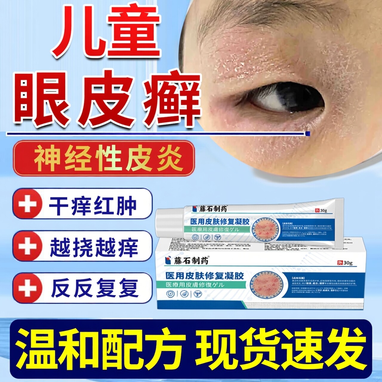 儿童眼皮癣眼睛周围干燥起皮红肿过敏神经性皮炎眼周毒癣康JW