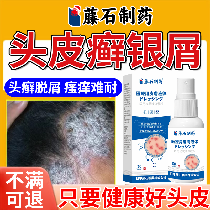 【直击头皮银屑牛皮癣】现货速发