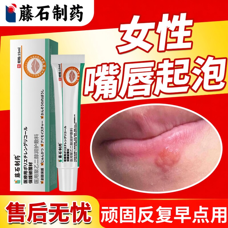 藤石制药嘴唇疱疹嘴巴上火起水泡烂嘴角特口唇效单纯带状疱疹膏DZ