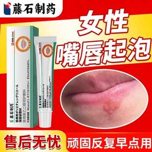 藤石制药嘴唇疱疹嘴巴上火起水泡烂嘴角特口唇效单纯带状疱疹膏DZ