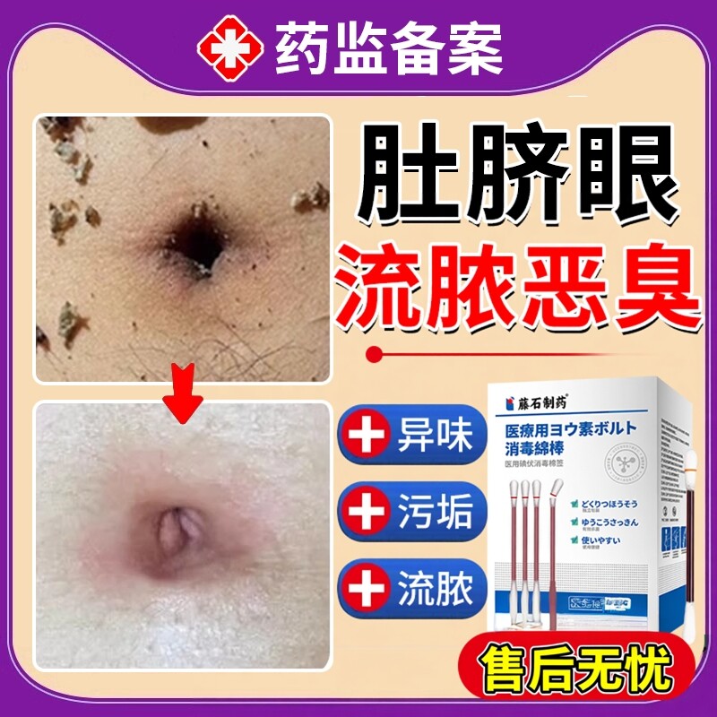 肚脐眼脏臭清洁神器除臭肚挤眼清理肚脐泥洗不掉如何清洗无刺激EM
