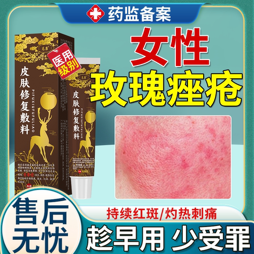 【医用级别】玫瑰痤疮屏障修护膏