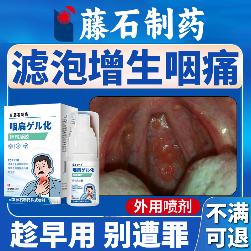 滤泡增生咽痛】趁早用别遭罪