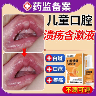 鹅口疮喷剂可搭碳酸氢钠广西上梨口喷制霉菌素混悬液非婴儿凝胶EM