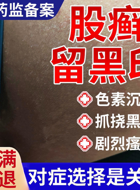 股藓癣去黑印专用大腿内侧皮肤瘙痒发黑色素沉淀去除药房款软膏BS