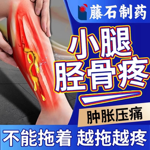 胫骨骨膜炎专用内侧应力综合症小腿酸胀痛消骨头疼炎膏药贴OZ