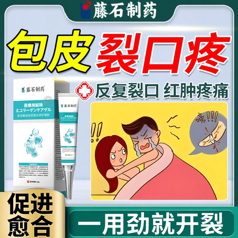 包皮开裂发炎痒红肿烂男性裂口子特龟头炎效白垢水肿药房同款膏BS