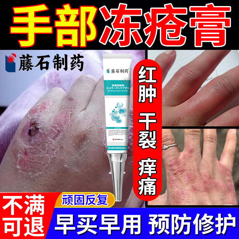 藤石制药】手动伤红肿痒痛冻疮膏